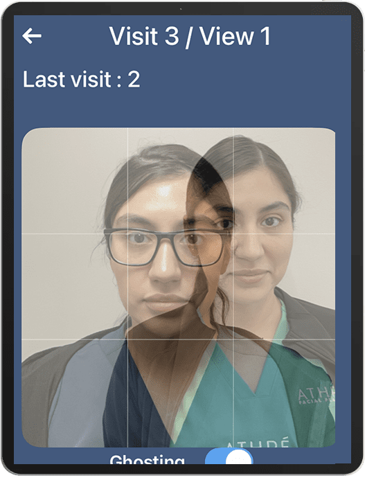 Perfect Photo Before and After Ghosting Feature